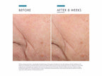 Triple Lipid Restore 2:4:2